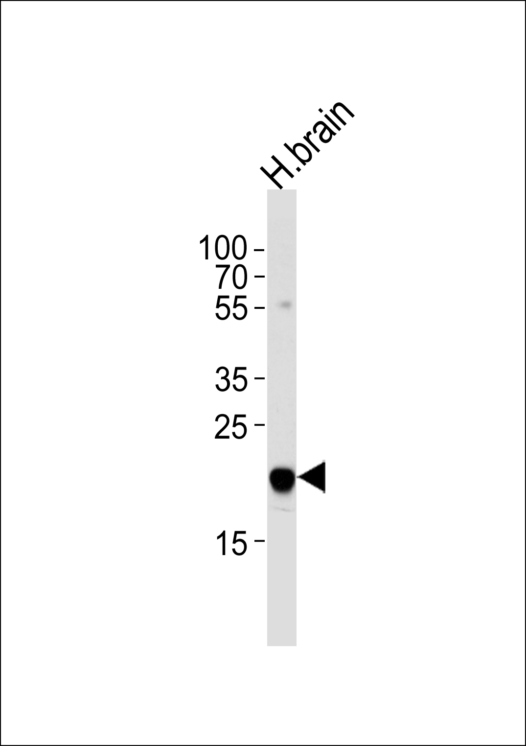 Rabbit Polyclonal Antibody to CNRP1