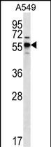 Rabbit Polyclonal Antibody to SPNS3