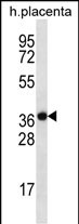 Rabbit Polyclonal Antibody to SLC38A8