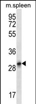 Rabbit Polyclonal Antibody to KRT222P