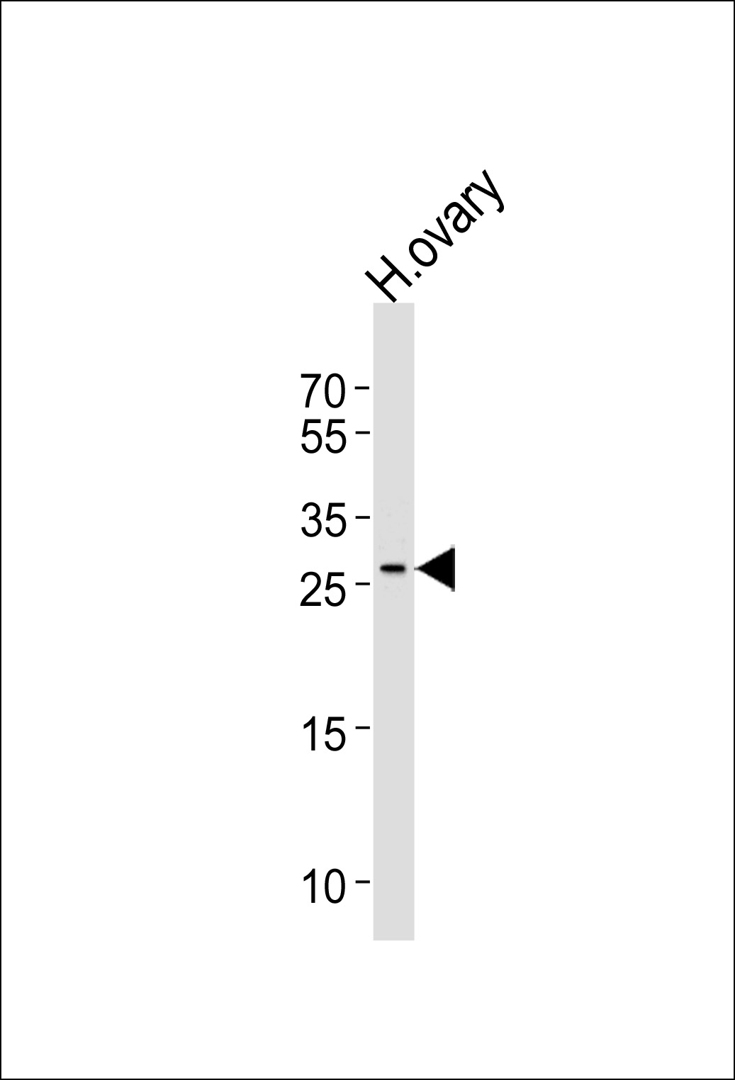 Rabbit Polyclonal Antibody to LRRN4CL
