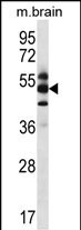 Rabbit Polyclonal Antibody to GPS1