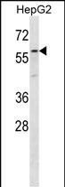 Rabbit Polyclonal Antibody to ZP4