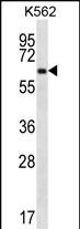 Rabbit Polyclonal Antibody to ZNF623