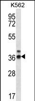 Rabbit Polyclonal Antibody to RPP38
