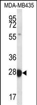 Rabbit Polyclonal Antibody to RAB27B