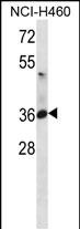 Rabbit Polyclonal Antibody to ATP1B3