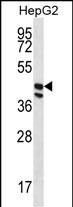 Rabbit Polyclonal Antibody to POFUT1