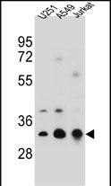 Rabbit Polyclonal Antibody to TPM4 (N-term)