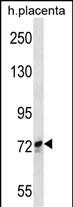 Rabbit Polyclonal Antibody to SCYL1 (N-term)