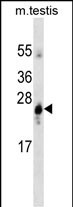 Mouse Monoclonal Antibody to GSTA1