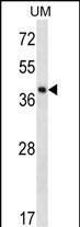 Rabbit Polyclonal Antibody to SPOPL