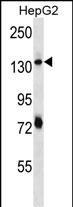 Rabbit Polyclonal Antibody to PLEKHH1