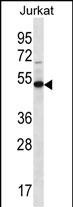 Rabbit Polyclonal Antibody to FA8A1 (N-term)