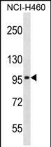Rabbit Polyclonal Antibody to SLC8A3
