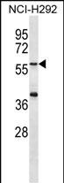 Rabbit Polyclonal Antibody to MATN1
