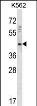 Rabbit Polyclonal Antibody to DOC2A