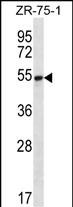 Rabbit Polyclonal Antibody to SEC62 (N-term)