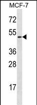 Rabbit Polyclonal Antibody to LAD1 (N-term)