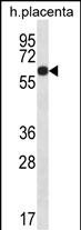 Rabbit Polyclonal Antibody to GLCCI1