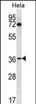 Rabbit Polyclonal Antibody to NUP35