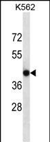 Rabbit Polyclonal Antibody to CACNG4