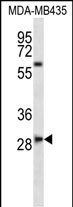 Rabbit Polyclonal Antibody to SLAMF8