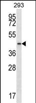 Rabbit Polyclonal Antibody to PTGR2 (N-term)