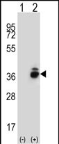 Rabbit Polyclonal Antibody to CRHBP (N-term)