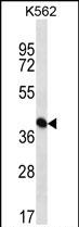 Rabbit Polyclonal Antibody to PAICS (N-term)