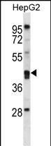 Rabbit Polyclonal Antibody to PON2 (N-term)