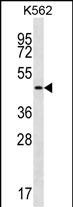 Rabbit Polyclonal Antibody to GIF