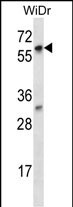 Rabbit Polyclonal Antibody to LARP7