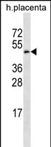 Rabbit Polyclonal Antibody to GAL3ST4