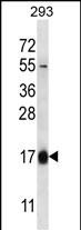 Rabbit Polyclonal Antibody to HBQ1 (N-term)