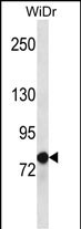 Rabbit Polyclonal Antibody to LZTS2