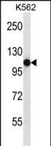 Rabbit Polyclonal Antibody to SEMA4C