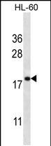 Rabbit Polyclonal Antibody to TMM70