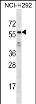 Rabbit Polyclonal Antibody to ODF2L
