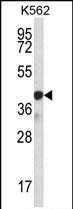 Rabbit Polyclonal Antibody to SP6