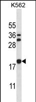 Rabbit Polyclonal Antibody to STMN3