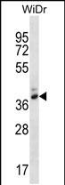 Rabbit Polyclonal Antibody to PGA4