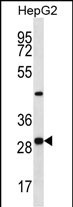 Rabbit Polyclonal Antibody to PROSC