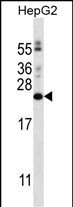 Rabbit Polyclonal Antibody to PIGH (N-term)