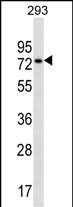 Rabbit Polyclonal Antibody to CCDC55 (N-term)