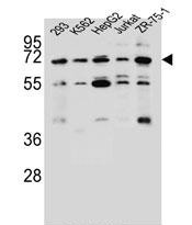 Rabbit Polyclonal Antibody to KCNV2