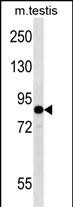 Rabbit Polyclonal Antibody to EIF2B5 (N-term)