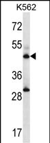 Rabbit Polyclonal Antibody to ADSS