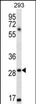 Rabbit Polyclonal Antibody to MESP1 (N-term)
