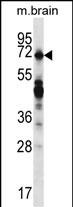 Rabbit Polyclonal Antibody to REPS2 (N-term)
